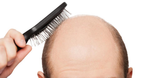 o-HAIR-LOSS-facebook