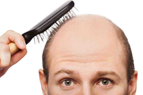 prp-hair-treatment-1
